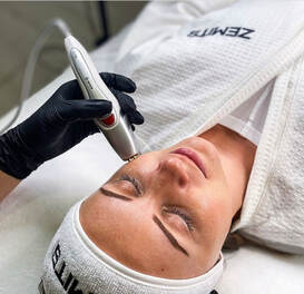 Figure 1 from Noninvasive radio frequency for skin tightening and